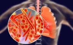 国金证券销户需要多久?